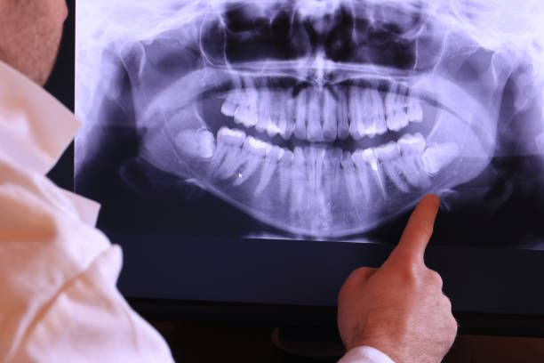 Best Pediatric Emergency Dentist in Estherville, IA
